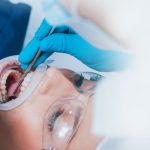 Dr Benichou operation dents sagesse blog Toulouse
