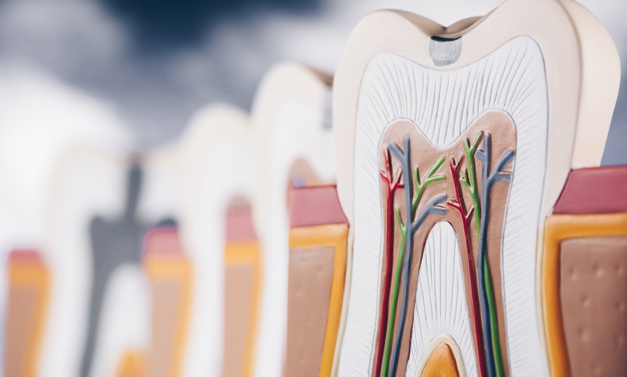 Traitements et retraitements endodontiques