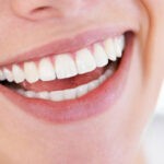 Détartrage dentaire chez le dentiste : un guide complet