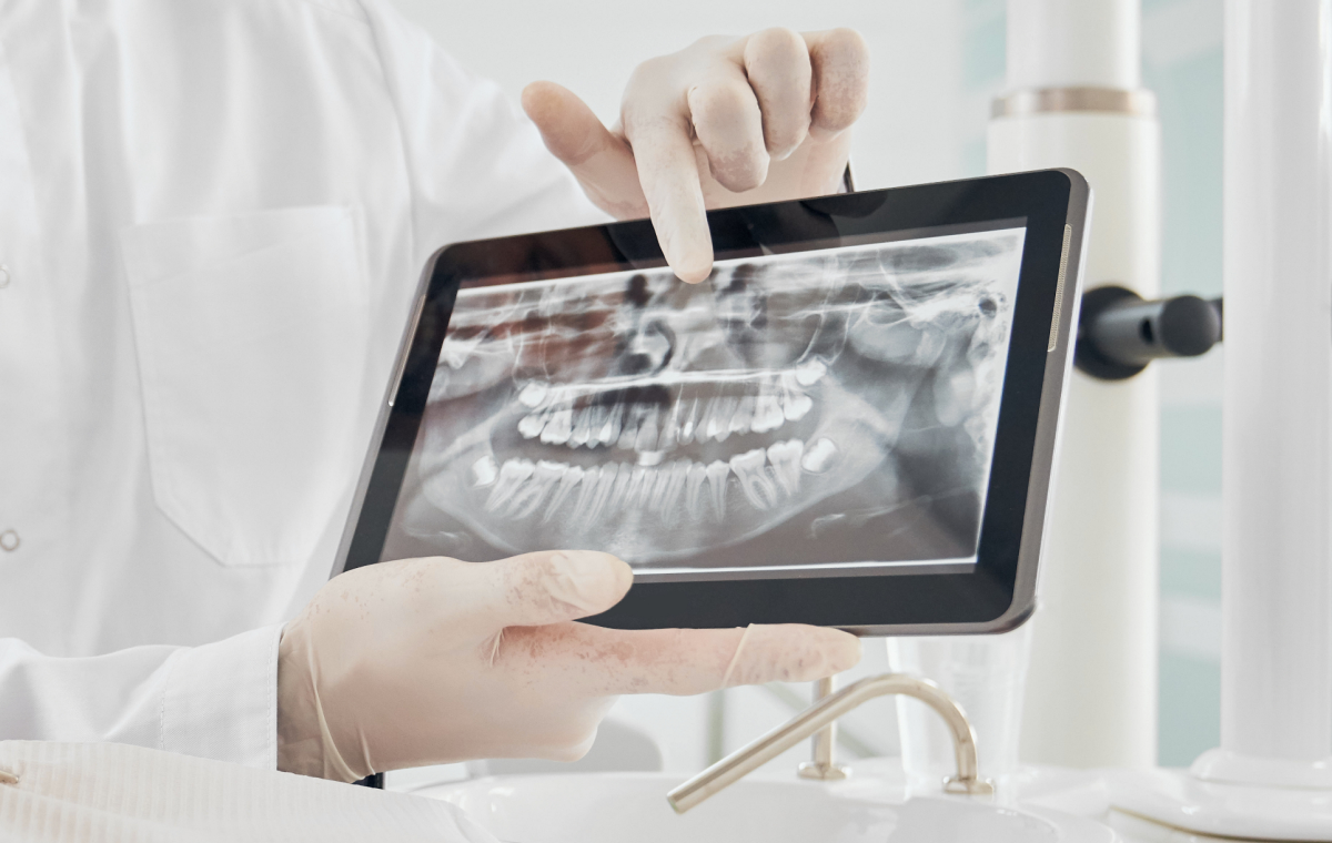 Cone Beam Dentaire à Toulouse : avantages de la modélisation 3D