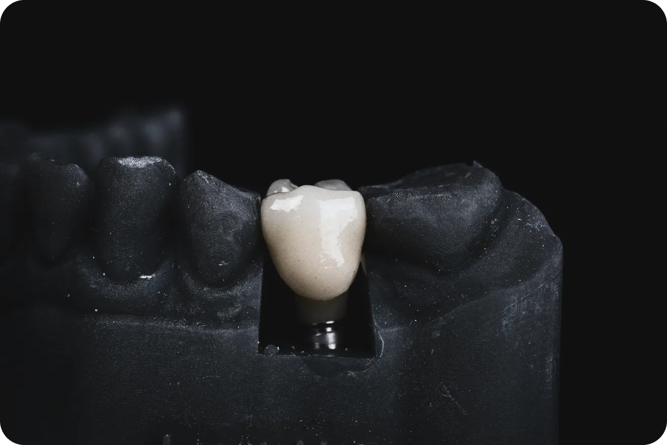 Dentiste à Toulouse, Dentiste Mathieu Benichou