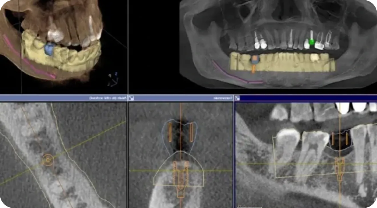 Confort & technologies Dentiste à Toulouse - Dentiste Mathieu Benichou