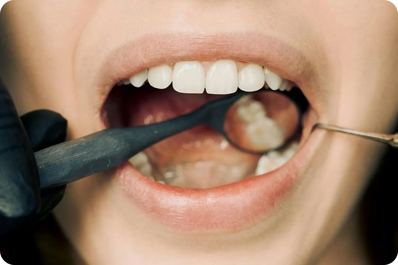 Conseils pré-opératoires Dentiste à Toulouse, Dentiste Mathieu Benichou