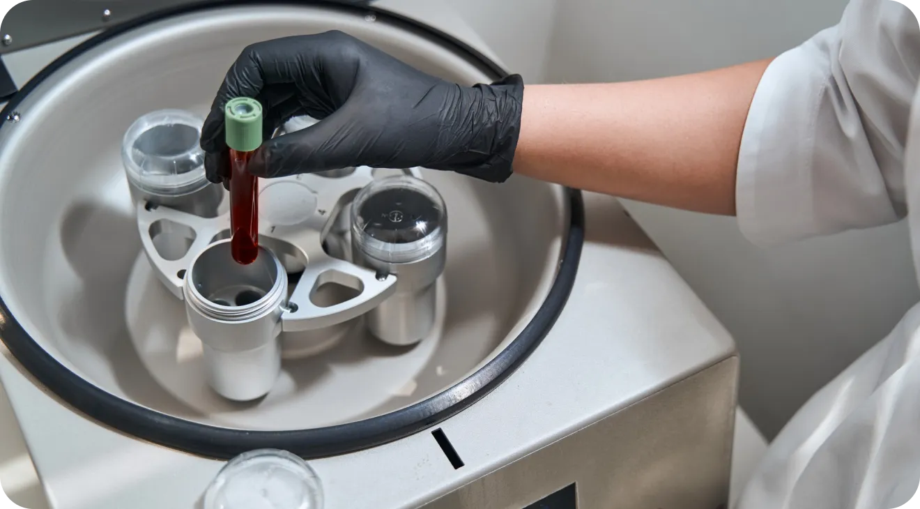 Toutes nos interventions chirurgicales sont réalisés à l’aide du PRF (Platelet rich fibrin)