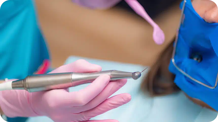 Le traitement canalaire sous digue Dentiste à Toulouse, Dentiste Mathieu Benichou