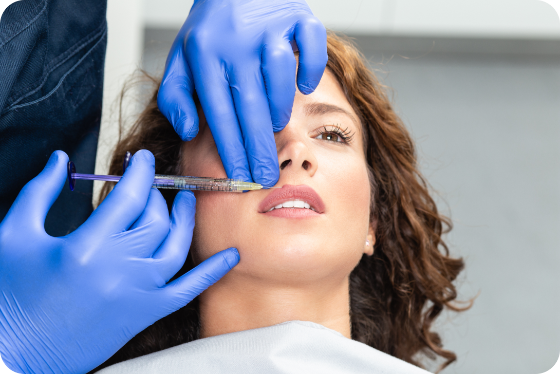 Injection d’acide hyaluronique pour les lèvres et le sillon naso-génien à Toulouse Dentiste à Toulouse, Dentiste Mathieu Benichou