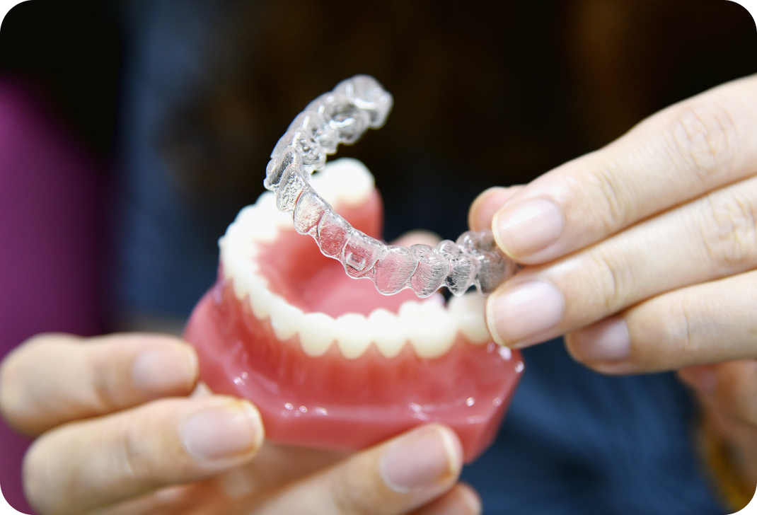 Invisalign et Orthodontie à Toulouse Dentiste à Toulouse, Dentiste Mathieu Benichou