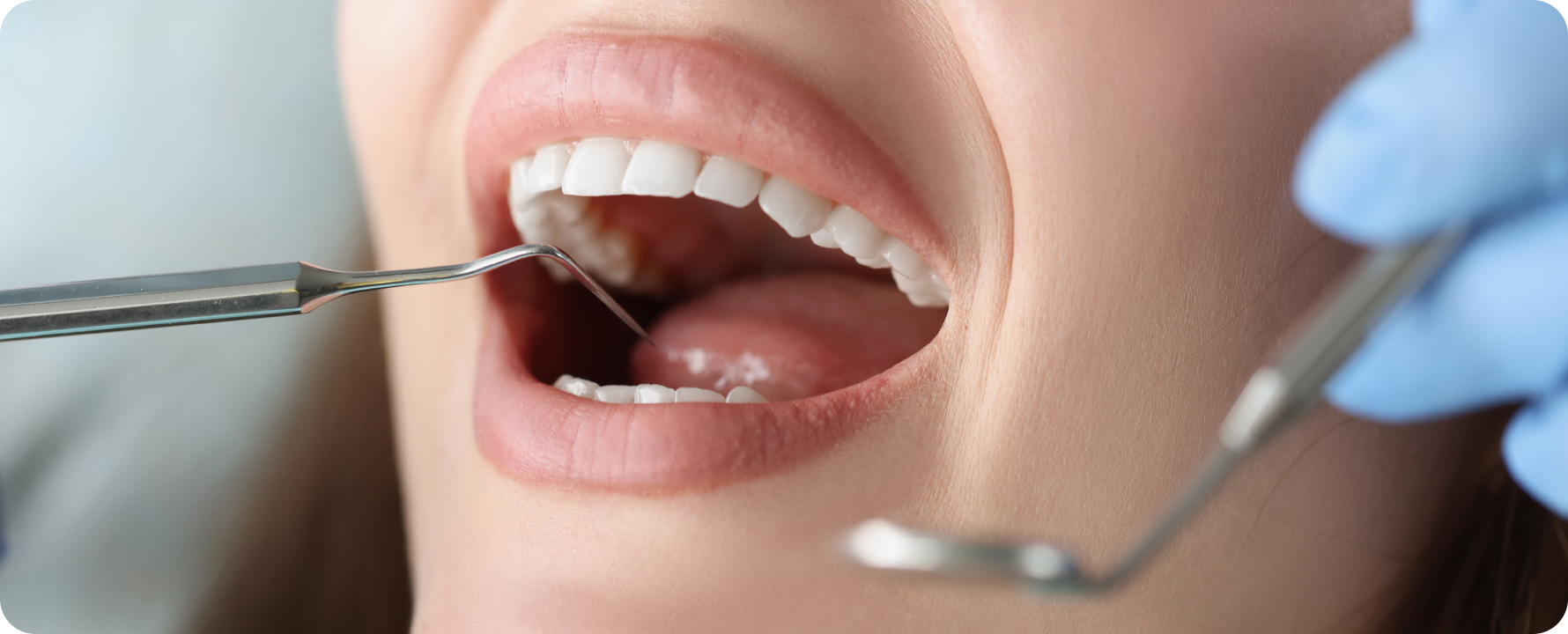 Examen bucco-dentaire à Toulouse Dentiste à Toulouse, Dentiste Mathieu Benichou