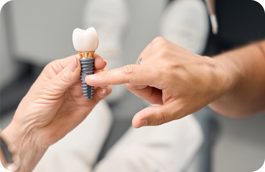 Implant dentaire & douleur – Dr Mathieu Benichou Dentiste à Toulouse, Dentiste Mathieu Benichou