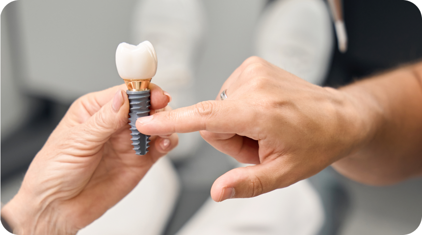 Implant dentaire à Toulouse Dentiste à Toulouse, Dentiste Mathieu Benichou