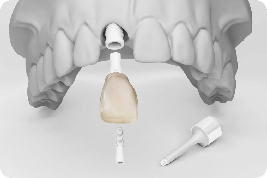 Dentisterie holistique Dentiste à Toulouse, Dentiste Mathieu Benichou
