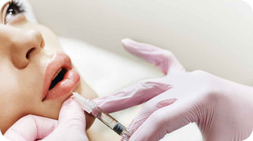 Injection d’acide hyaluronique pour les lèvres et le sillon naso-génien à Toulouse Dentiste à Toulouse, Dentiste Mathieu Benichou