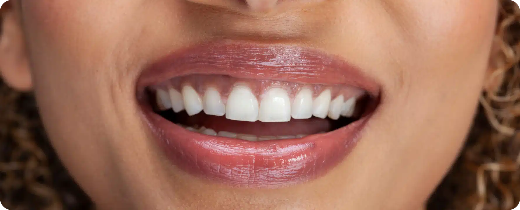Maladie parodontale : causes, symptômes et traitements ! Dentiste à Toulouse, Dentiste Mathieu Benichou