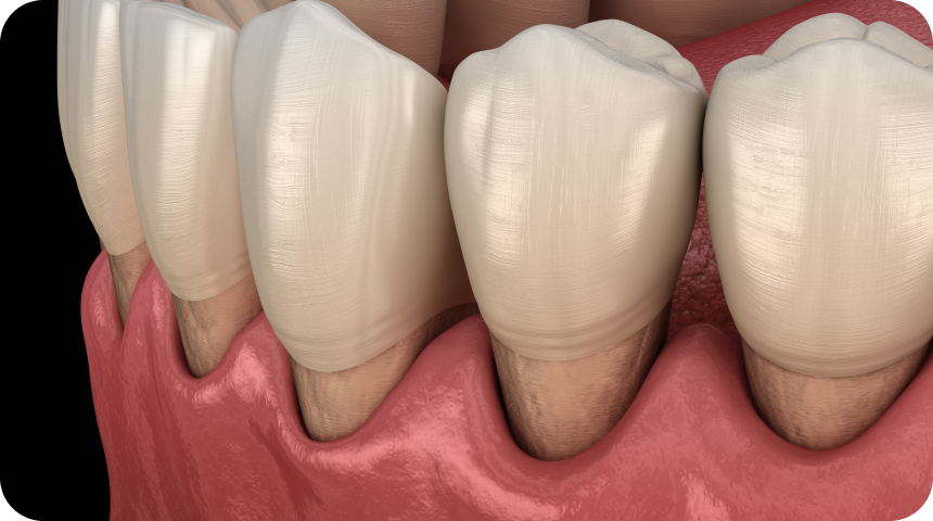 Parodontologie à Toulouse Dentiste à Toulouse, Dentiste Mathieu Benichou