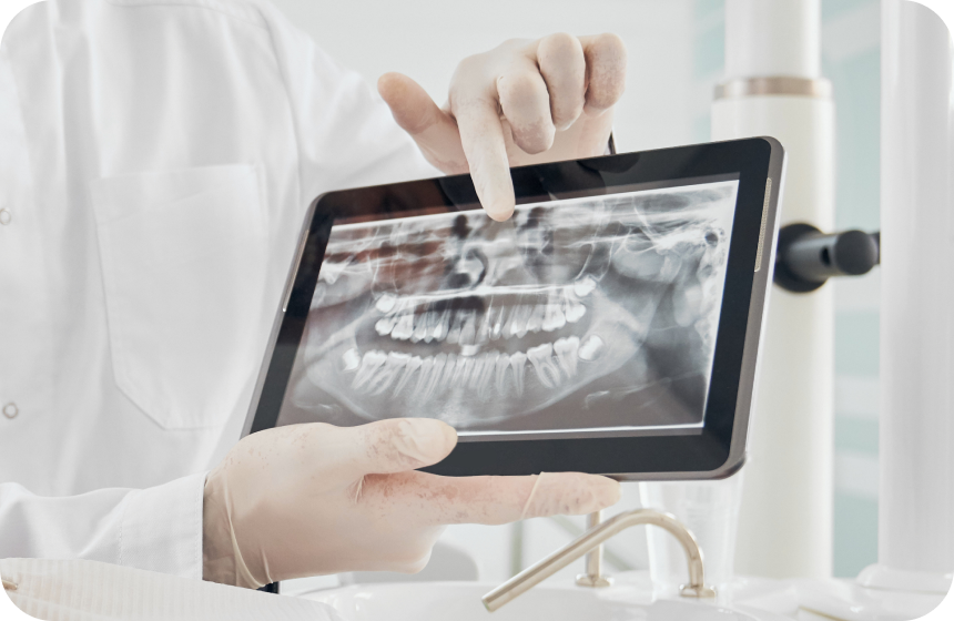 Cone Beam Dentaire à Toulouse : avantages de la modélisation 3D Dentiste à Toulouse, Dentiste Mathieu Benichou